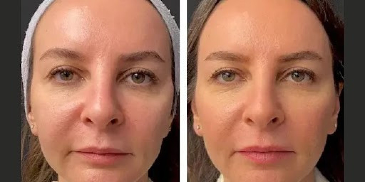 Best Aesthetic Clinic in Dubai: Safety Standards and Technology